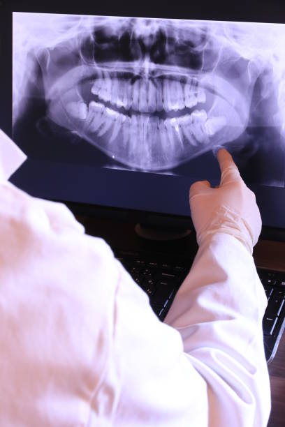 Best Emergency Dental Extractions in Oil City, PA