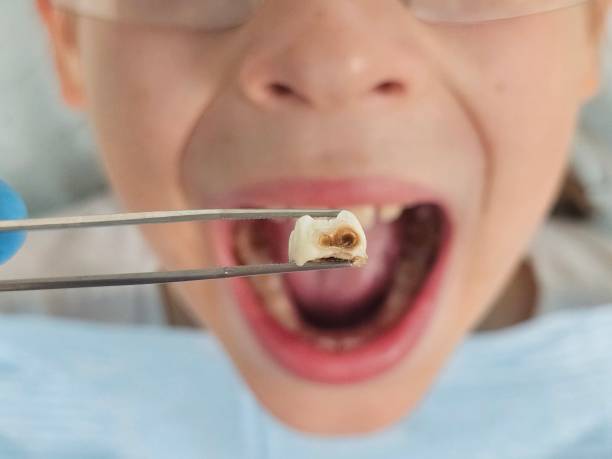 Best Emergency Dentist for Knocked-Out Tooth in Oil City, PA